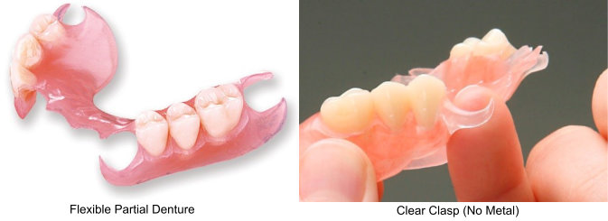 partial-dentures