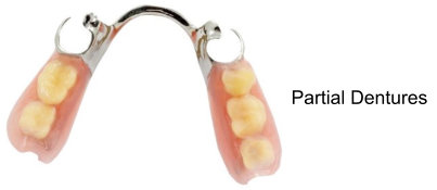 partial-dentures